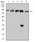 Mouse Monoclonal Antibody to DDX1